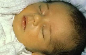 دستگاه زردی